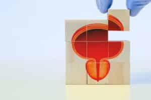 Prostate medical checkup.  The doctor's hand arranges the wooden cubes with the drawing of a bladder and a prostate